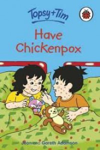 Topsy + Tim: have chickenpox